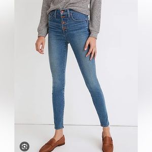 Madewell Mid Rise Skinny Jean Buttons